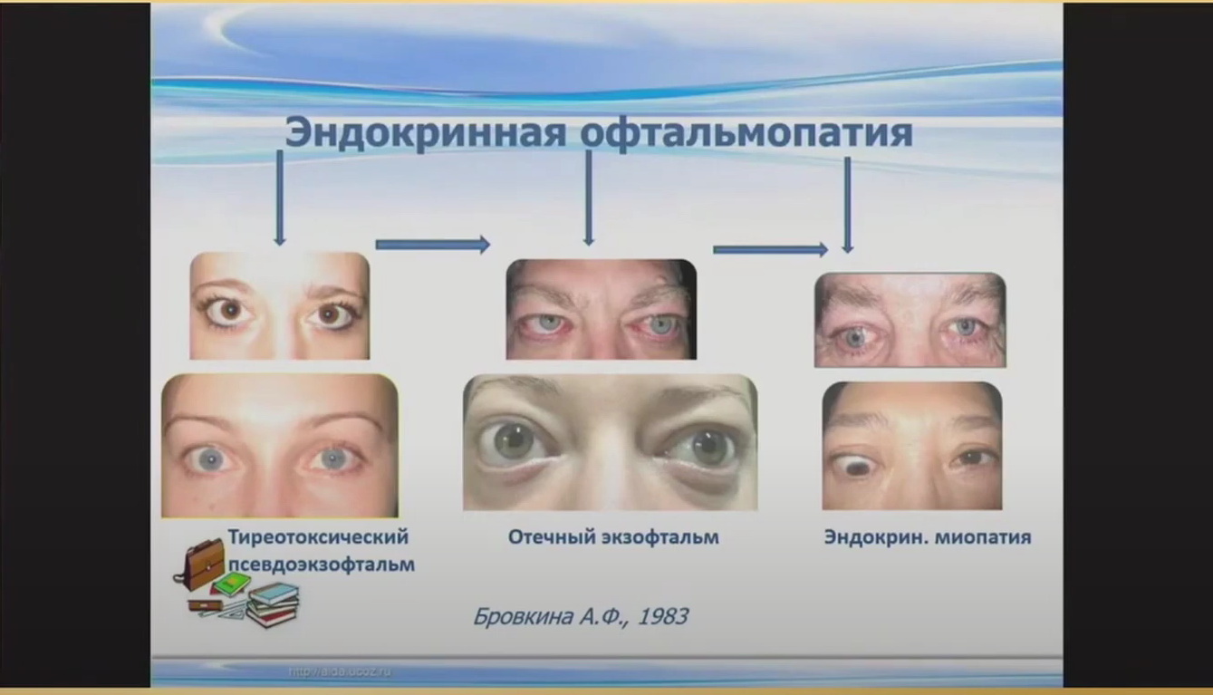 Офтальмогеронтология – инновационное решение проблем - Страница 3 из 3 -  Издательство АПРЕЛЬ