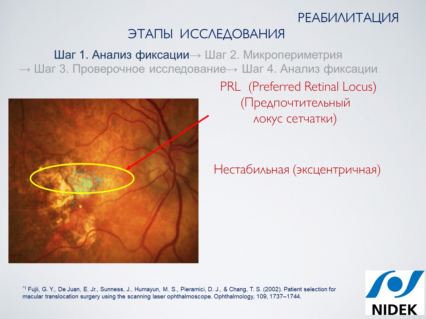 Новые возможности диагностики и лечения сетчатки - Издательство АПРЕЛЬ