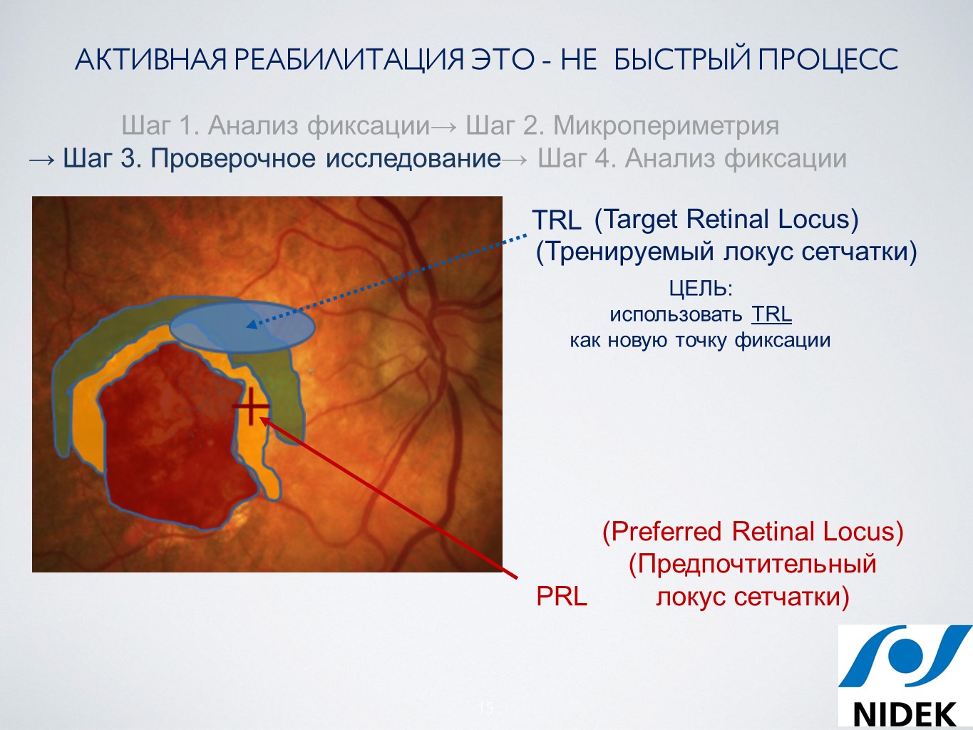 Новые возможности диагностики и лечения сетчатки - Издательство АПРЕЛЬ