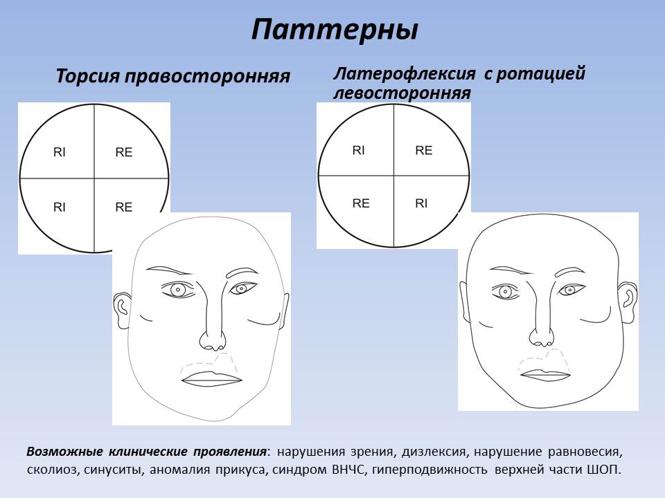 Глаза остеопатия что это. %D0%A0%D0%B8%D1%81. 2 12. Глаза остеопатия что это фото. Глаза остеопатия что это-%D0%A0%D0%B8%D1%81. 2 12. картинка Глаза остеопатия что это. картинка %D0%A0%D0%B8%D1%81. 2 12. Остеопатия как новое направление традиционной медицины использует комплексный метод. Конечно, здесь мы будем говорить только о терапии. Физически и анатомически косоглазие обычно связано с нарушением симметрии глазодвигательных мыщц, костей и близлежащих тканей лицевой части черепа. С течением времени диспропорция становится больше. И вот наконец, мы имеем ярко выраженный эффект, заметный не только врачу. Остеопатические техники и приёмы многообразны. Тем не менее, присутствует общий принцип снятия напряжений и соответственно деформаций в суставах и тканях. Несомненно, он применим по отношению к лицевому отделу черепа и эффективен при лечении косоглазия.