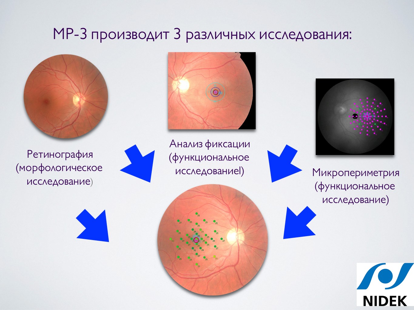 Новые возможности диагностики и лечения сетчатки - Издательство АПРЕЛЬ