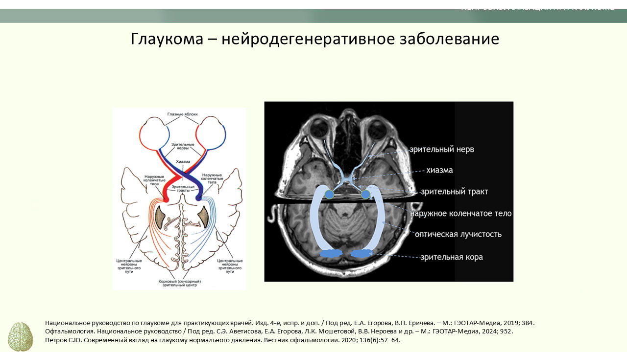 Структурные, функциональные и метаболические нейровизуализационные паттерны при глаукоме